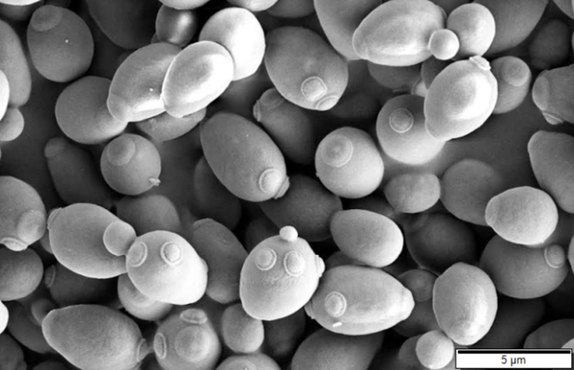 fig1_saccharomyces_cerevisiae_sem.jpg